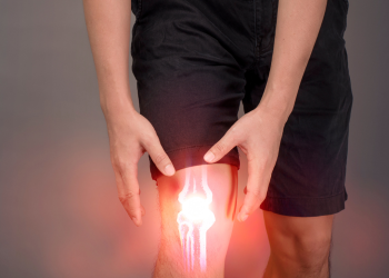 Total Knee Replacement